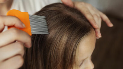 Quais as causas, sintomas e prevenção do piolho