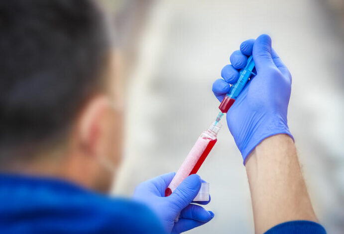 tratamento da esclerose múltipla