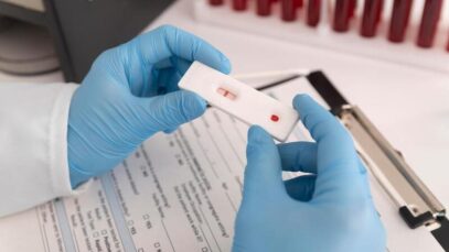 Testes rápidos de HIV podem ser feitos em farmácias