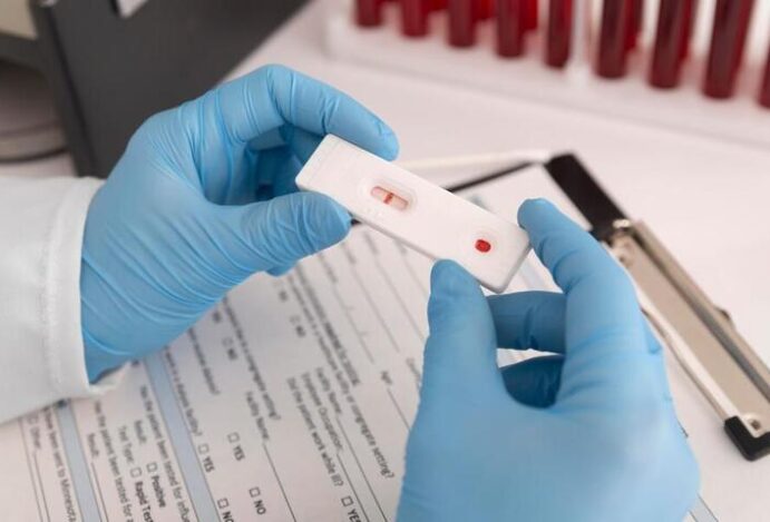 Testes rápidos de HIV